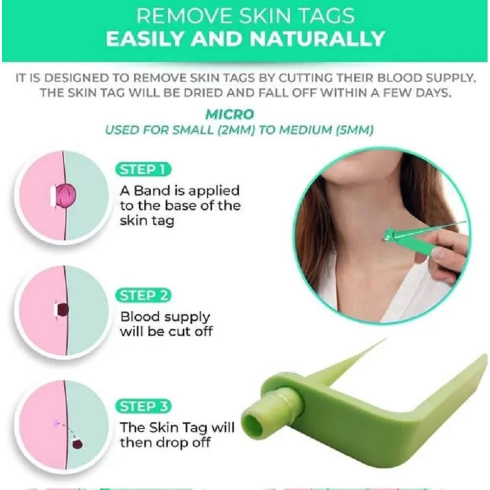 Skin Tag Rubber Band Removal Tool kit
