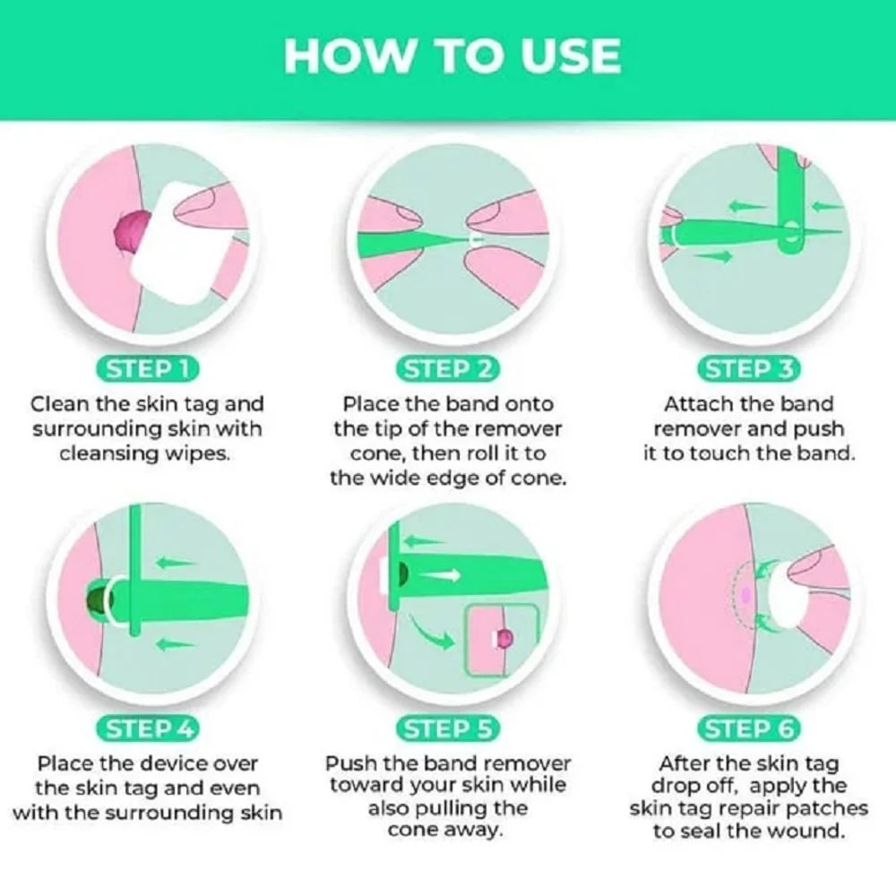 Skin Tag Rubber Band Removal Tool kit 2