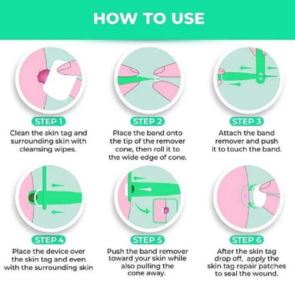 Skin Tag Rubber Band Removal Tool kit 2